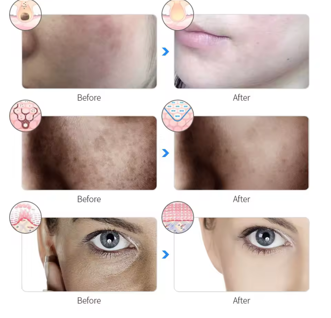 LED Light Therapy Face Mask    – Advanced Skincare Treatment at Home